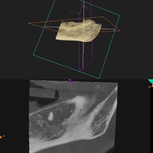 Section Preparation and Reporting on Cone-Beam Computed Tomography Images