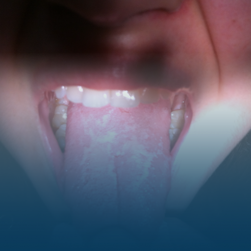 Diagnostic Evaluation Methods in Oral Diseases Course 
