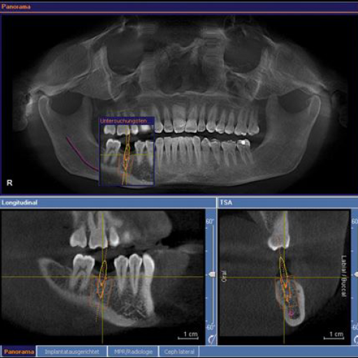 Cone Beam Computed Tomography Course