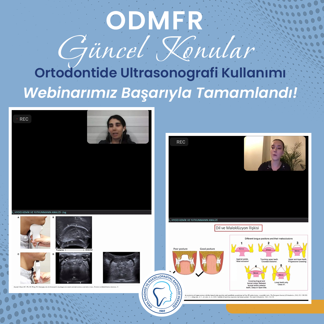 Güncel Konular, Ortodontide Ultrasonografi Kullanımı