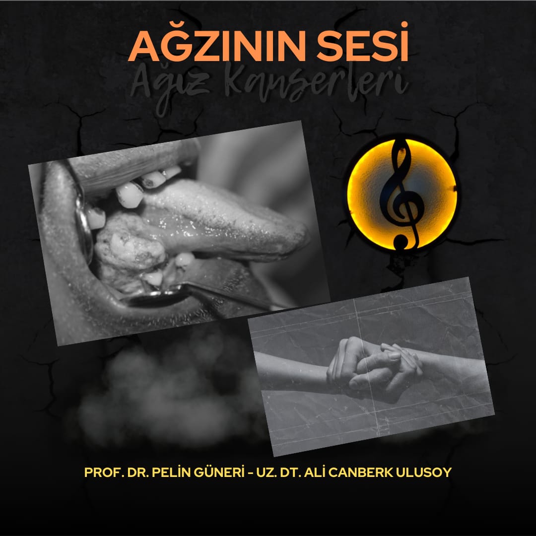 "Ağzının Sesi" Şarkısı