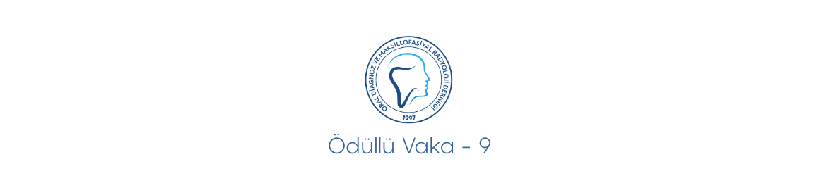 Ödüllü Vaka 9