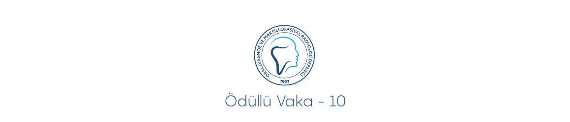 Ödüllü Vaka 10